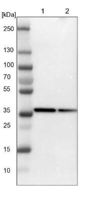 Western Blot: CSRNP3 Antibody [NBP1-83933]