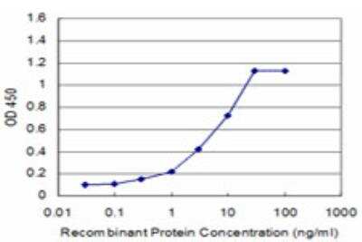 ELISA: CSRP1 Antibody (2A11) [H00001465-M06]