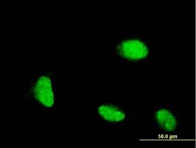 Immunocytochemistry/ Immunofluorescence: CSRP1 Antibody (2A11) [H00001465-M06]