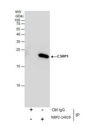 Immunoprecipitation: CSRP1 Antibody [NBP2-14919]