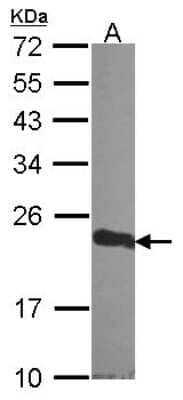 Western Blot: CSRP1 Antibody [NBP2-14919]