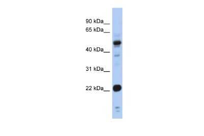 Western Blot: CSRP1 Antibody [NBP2-88794]