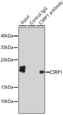 Western Blot: CSRP1 AntibodyBSA Free [NBP2-92936]