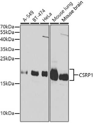 Western Blot: CSRP1 AntibodyBSA Free [NBP2-92936]