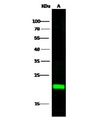 Western Blot: CSRP1 Antibody [NBP2-99738]