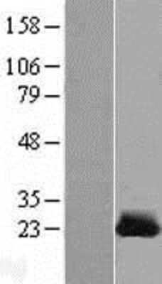 Western Blot: CSRP1 Overexpression Lysate [NBL1-09539]