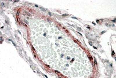 Immunohistochemistry-Paraffin: CSRP2 Antibody [NB100-77341]