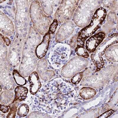 Immunohistochemistry-Paraffin: CSRP2 Antibody [NBP2-13879]