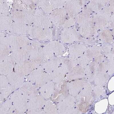 Immunohistochemistry-Paraffin: CSRP2 Antibody [NBP2-13879]