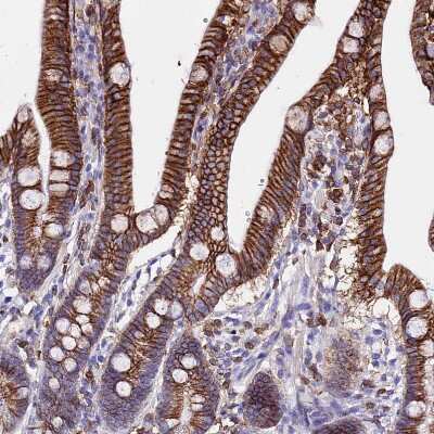 Immunohistochemistry-Paraffin: CSRP2 Antibody [NBP2-13879]
