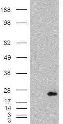 Western Blot: CSRP2 Antibody [NB100-77341]