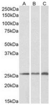 Western Blot: CSRP2 Antibody [NB100-77341]