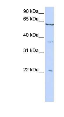 Western Blot: CSRP2 Antibody [NBP1-80293]