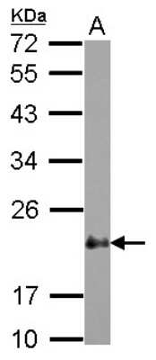 Western Blot: CSRP2 Antibody [NBP2-16021]