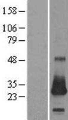 Western Blot: CSRP2 Overexpression Lysate [NBL1-09540]