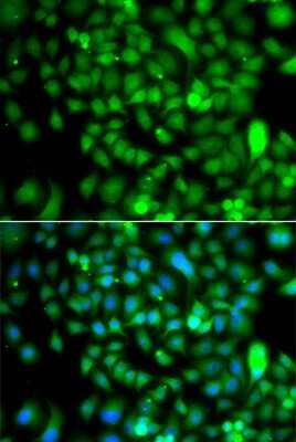 Immunocytochemistry/ Immunofluorescence: CSRP2BP Antibody - BSA Free [NBP2-92912]