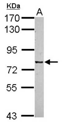 Western Blot: CSRP2BP Antibody [NBP2-14920]