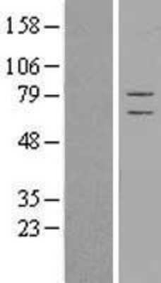 Western Blot: CSRP2BP Overexpression Lysate [NBL1-09541]