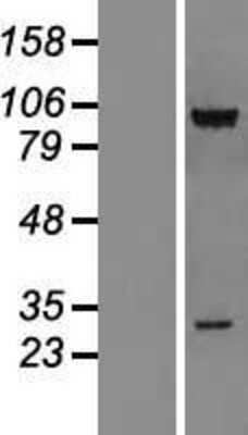 Western Blot: CSRP2BP Overexpression Lysate [NBL1-09542]