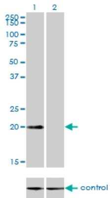 Western Blot: CSRP3 Antibody (6D2) [H00008048-M03]