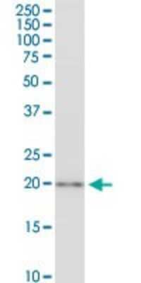 Western Blot: CSRP3 Antibody (6D2) [H00008048-M03]