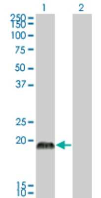 Western Blot: CSRP3 Antibody (6D2) [H00008048-M03]