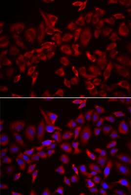 Immunocytochemistry/ Immunofluorescence: CSRP3 Antibody - BSA Free [NBP3-04494]