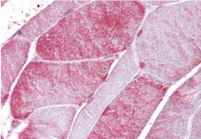 Immunohistochemistry-Paraffin: CSRP3 Antibody [NBP1-06983]