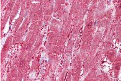 Immunohistochemistry-Paraffin: CSRP3 Antibody [NBP1-06983]