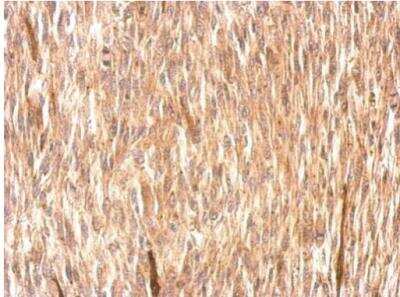 Immunohistochemistry-Paraffin: CSRP3 Antibody [NBP1-32974]