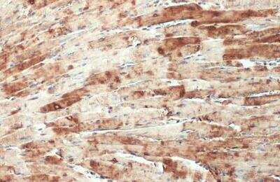Immunohistochemistry-Paraffin: CSRP3 Antibody [NBP1-32974]