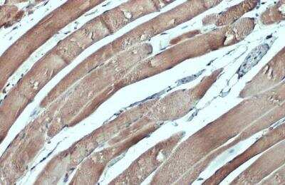 Immunohistochemistry-Paraffin: CSRP3 Antibody [NBP1-32974]