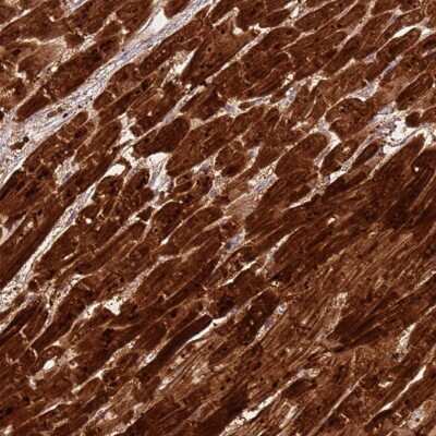 Immunohistochemistry-Paraffin: CSRP3 Antibody [NBP2-13880]