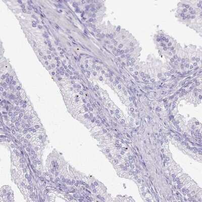 Immunohistochemistry-Paraffin: CSRP3 Antibody [NBP2-13880]