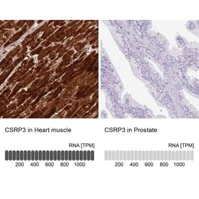 Immunohistochemistry-Paraffin: CSRP3 Antibody [NBP2-13880]