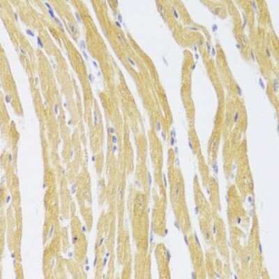 Immunohistochemistry-Paraffin: CSRP3 Antibody - BSA Free [NBP2-92797]