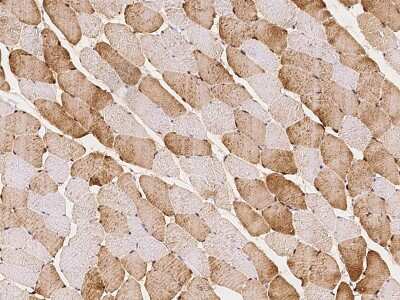 Immunohistochemistry-Paraffin: CSRP3 Antibody [NBP2-97433]