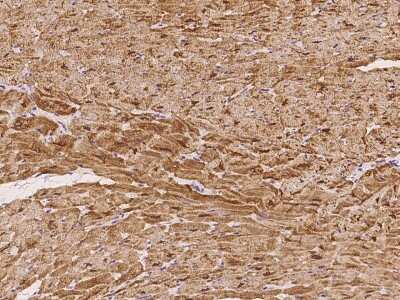 Immunohistochemistry-Paraffin: CSRP3 Antibody [NBP2-97433]