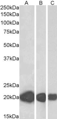 Western Blot: CSRP3 Antibody [NBP1-06983]