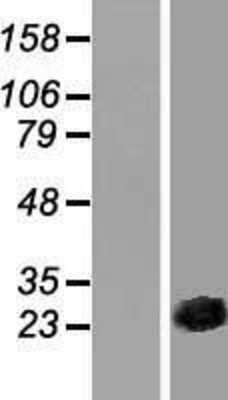 Western Blot: CSRP3 Overexpression Lysate [NBL1-09543]