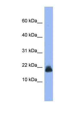 Western Blot: Cystatin E/M/CST6 Antibody [NBP1-69005]