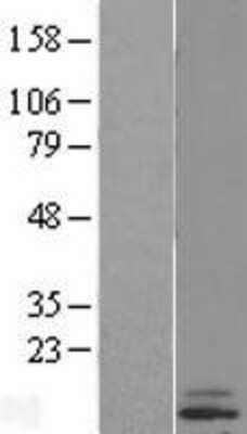 Western Blot: Cystatin E/M/CST6 Overexpression Lysate [NBL1-09549]