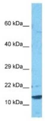 Western Blot: CST9L Antibody [NBP3-10654]