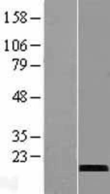 Western Blot: CST9L Overexpression Lysate [NBL1-09552]