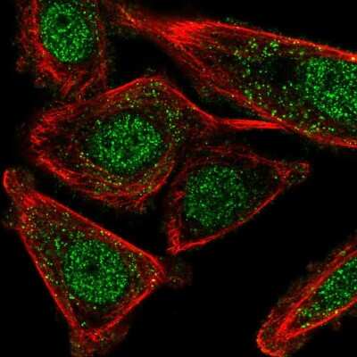 Immunocytochemistry/ Immunofluorescence: CSTF2T Antibody [NBP2-49353]