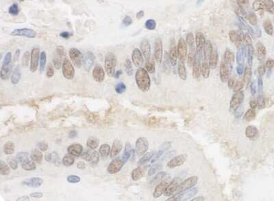 Immunohistochemistry: CSTF2T Antibody [NB100-74614]