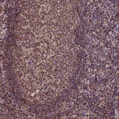 Immunohistochemistry-Paraffin: CSTF2T Antibody [NBP2-49353]