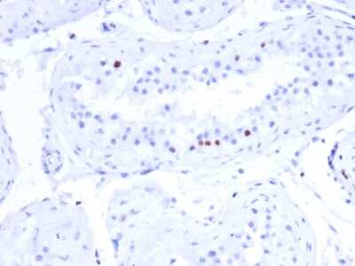 Immunohistochemistry-Paraffin: CSTF2T Antibody (PCRP-CSTF2T-1A3) [NBP3-07486]