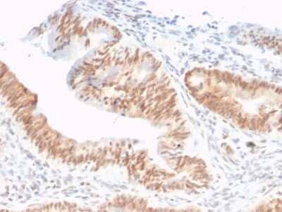 Immunohistochemistry-Paraffin: CSTF2T Antibody (PCRP-CSTF2T-1A3) [NBP3-07486]