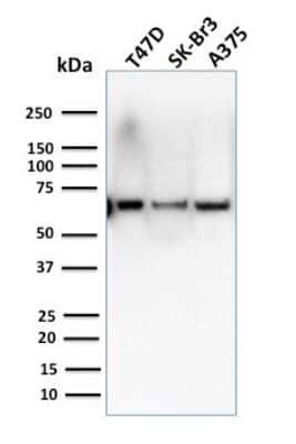 Western Blot: CSTF2T Antibody (PCRP-CSTF2T-1A3) [NBP3-07486]